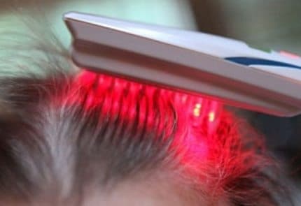 laser capelli funziona